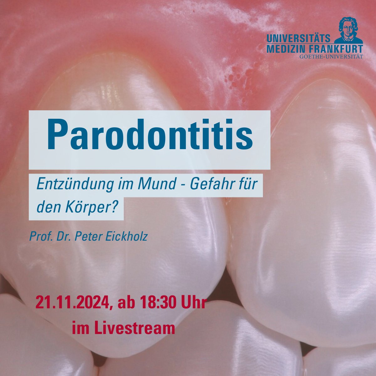 Universitätsmedizin Frankfurt (@uk_frankfurt) on Twitter photo Livestream: #Parodontitis – Gefahr für den Körper? Parodontitis kann zu Zahnverlust führen und wirkt sich negativ auf die Allgemeingesundheit aus, z.B. bei Diabetes.
📅 21.11.2024, 18:30 Uhr | Anonyme Fragen im Chat möglich 👉gesundheitsforum.unimedizin-ffm.de/buerger-und-pa… Livestream: #Parodontitis – Gefahr für den Körper? Parodontitis kann zu Zahnverlust führen und wirkt sich negativ auf die Allgemeingesundheit aus, z.B. bei Diabetes.
📅 21.11.2024, 18:30 Uhr | Anonyme Fragen im Chat möglich 👉gesundheitsforum.unimedizin-ffm.de/buerger-und-pa…