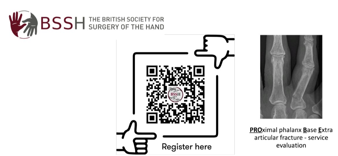 Full house at #bsshautumn2024 for discussion around the POINT trial and non-op treatment of prox phalanx fractures. Great discussion. Join our prospective evaluation of basal prox phalanx injuries at the QR code #handsurgery