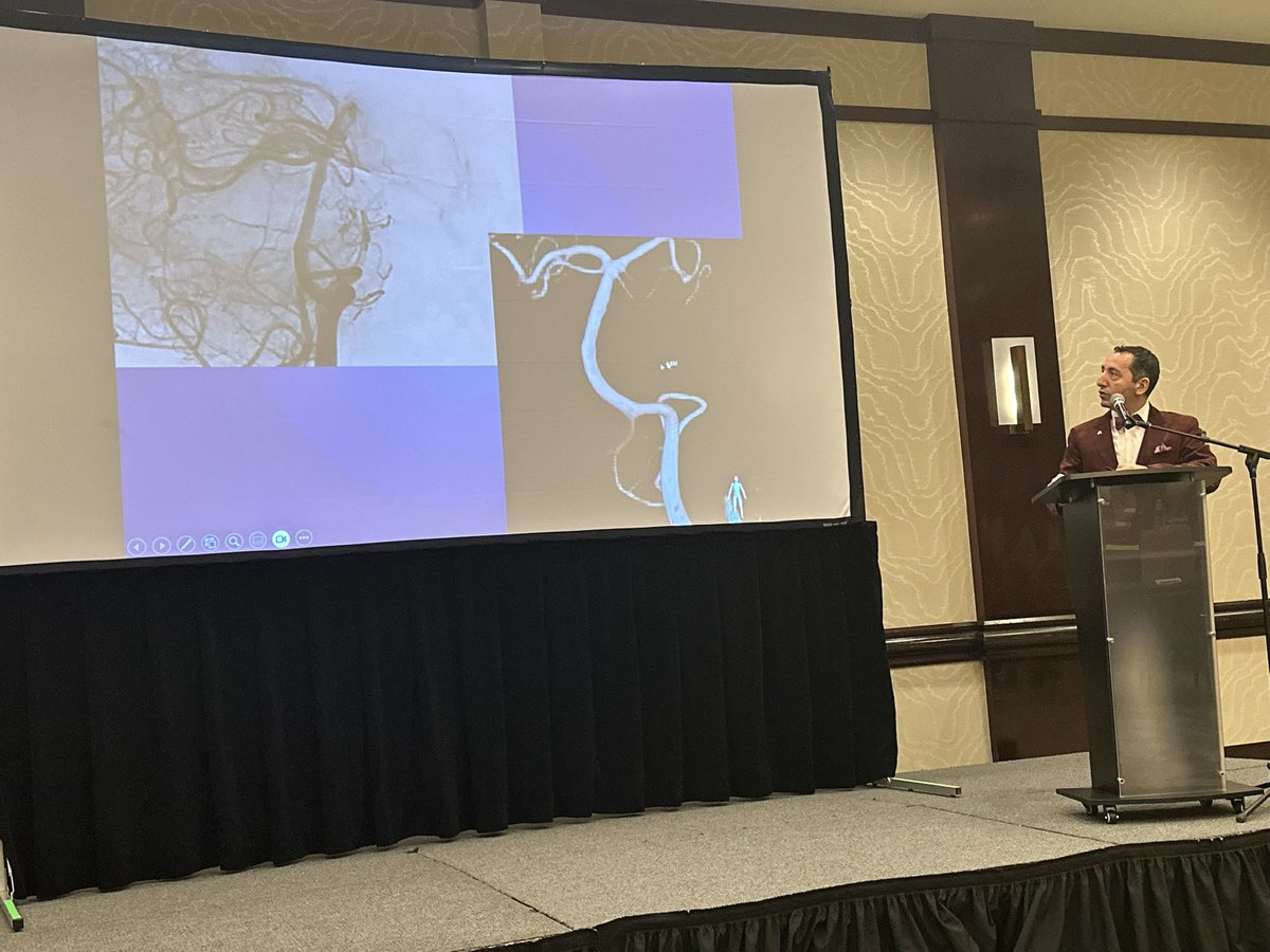 RitamGhoshMD's tweet image. Always a treat listening to @PascalJabbourMD talk about modern treatments for aneurysms! #NJNeuroscienceSymposium 

@JeffHealthNJ  @TJUHNeurosurg @NeuroatJeff