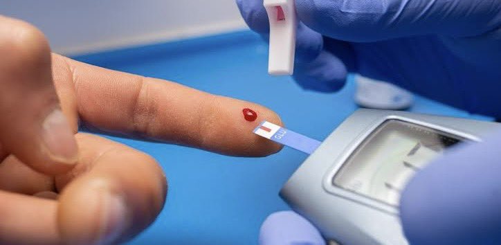 ArinaitweDr's tweet photo. Today, November 14th, we recognize World Diabetes Day! Let's shine a light on this condition that affects millions worldwide. #WorldDiabetesDay #DiabetesAwareness"
🧵 https://t.co/hae3SQGzLC