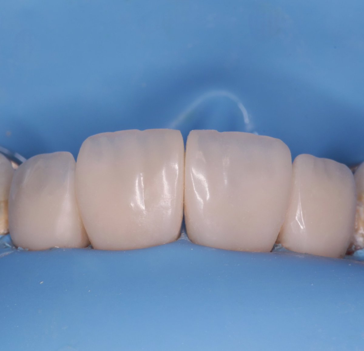 wasayef_h's tweet photo. Direct composite build-up by layering technique 🤍✨ https://t.co/5ltVuR8qJX