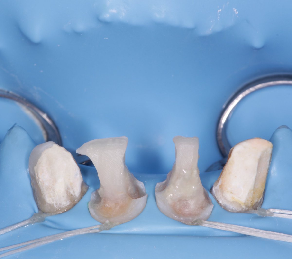 wasayef_h's tweet photo. Direct composite build-up by layering technique 🤍✨ https://t.co/5ltVuR8qJX