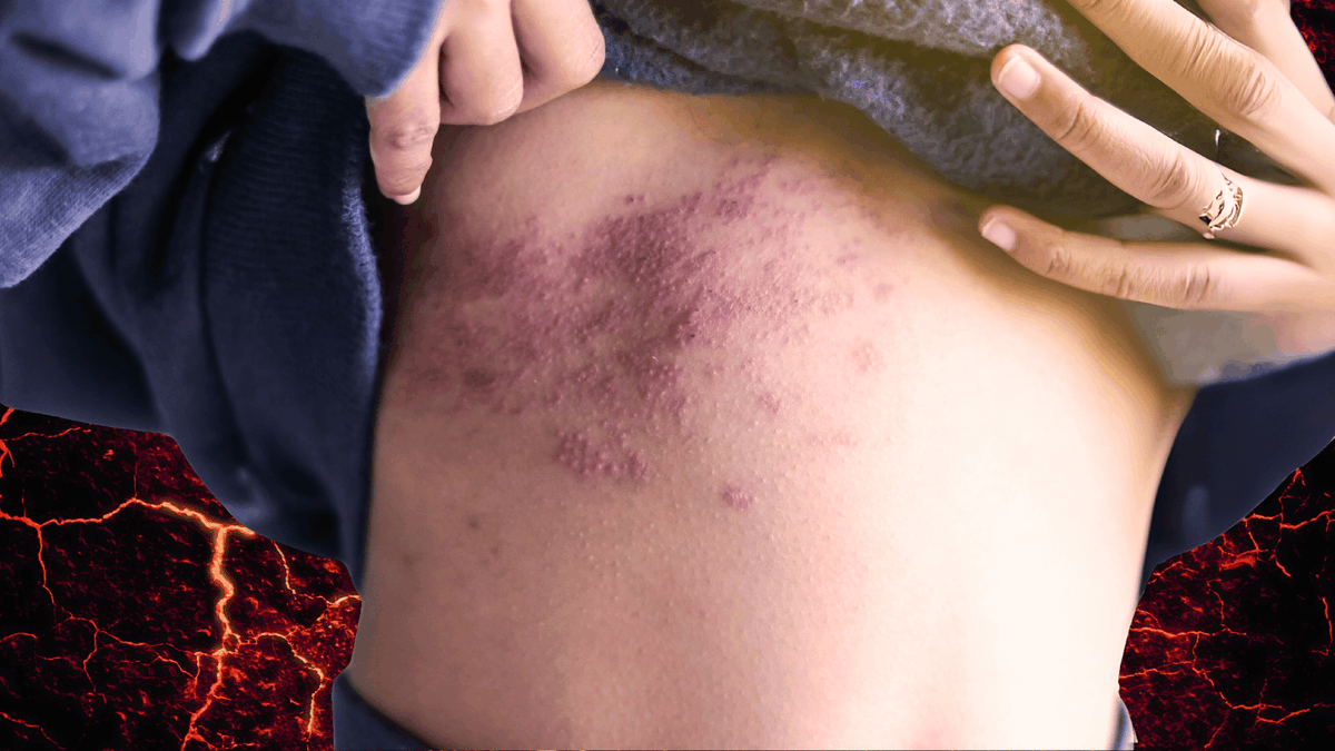 ByMrevista's tweet photo. Se estima que más del 18% de la población mexicana padece diabetes, ya sea diagnosticada o no. 🩸👇 https://t.co/nfVzROfqEv 
#diabetes #herpes #bymmagazine #bienestarysalud https://t.co/6gxfitIb6o