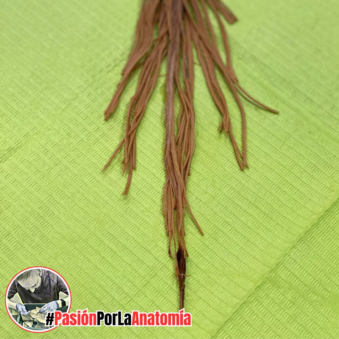 PasionAnatomia's tweet photo. La #ColaDeCaballo o #CaudaEquina es el conjunto de las raíces nerviosas de los #NerviosEspinales lumbares y sacros, junto con el #FilumTerminal, que se extiende desde la 1ª-2ª vertebral lumbar. https://t.co/hnAIxazz25