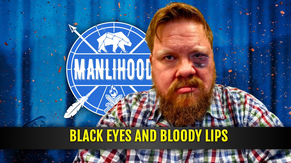 Manlihooddotcom's tweet image. 💥 Life hits hard, but resilience is built in the black eyes and bloody lips. Watch this episode on facing hardship with grit! youtu.be/JJCnKx676mA?si… #Manlihood #Resilience #Masculinity #PersonalDevelopment #PodcastForMen #Grit #Growth  #MentalToughness #LifeLessons #YouTube