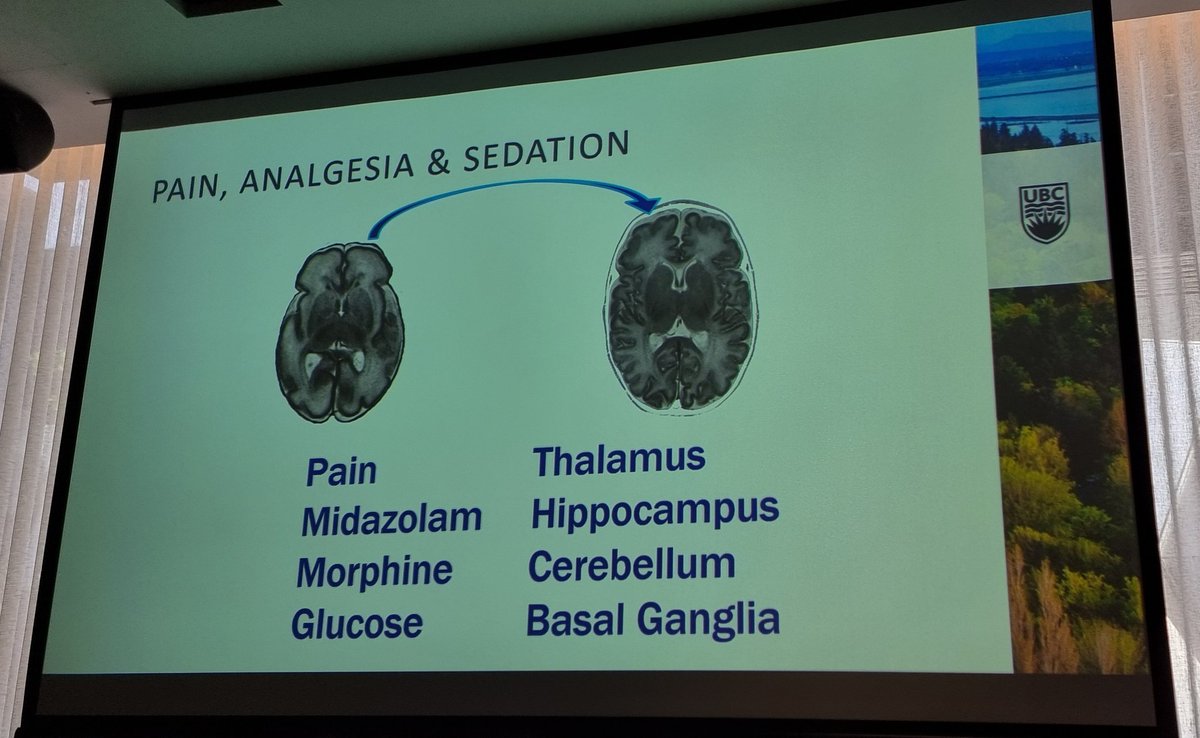 Australasian Brain Club tweet media