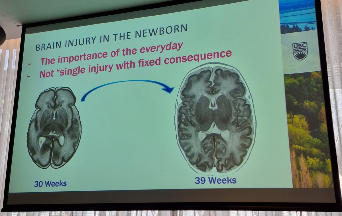 Australasian Brain Club tweet media