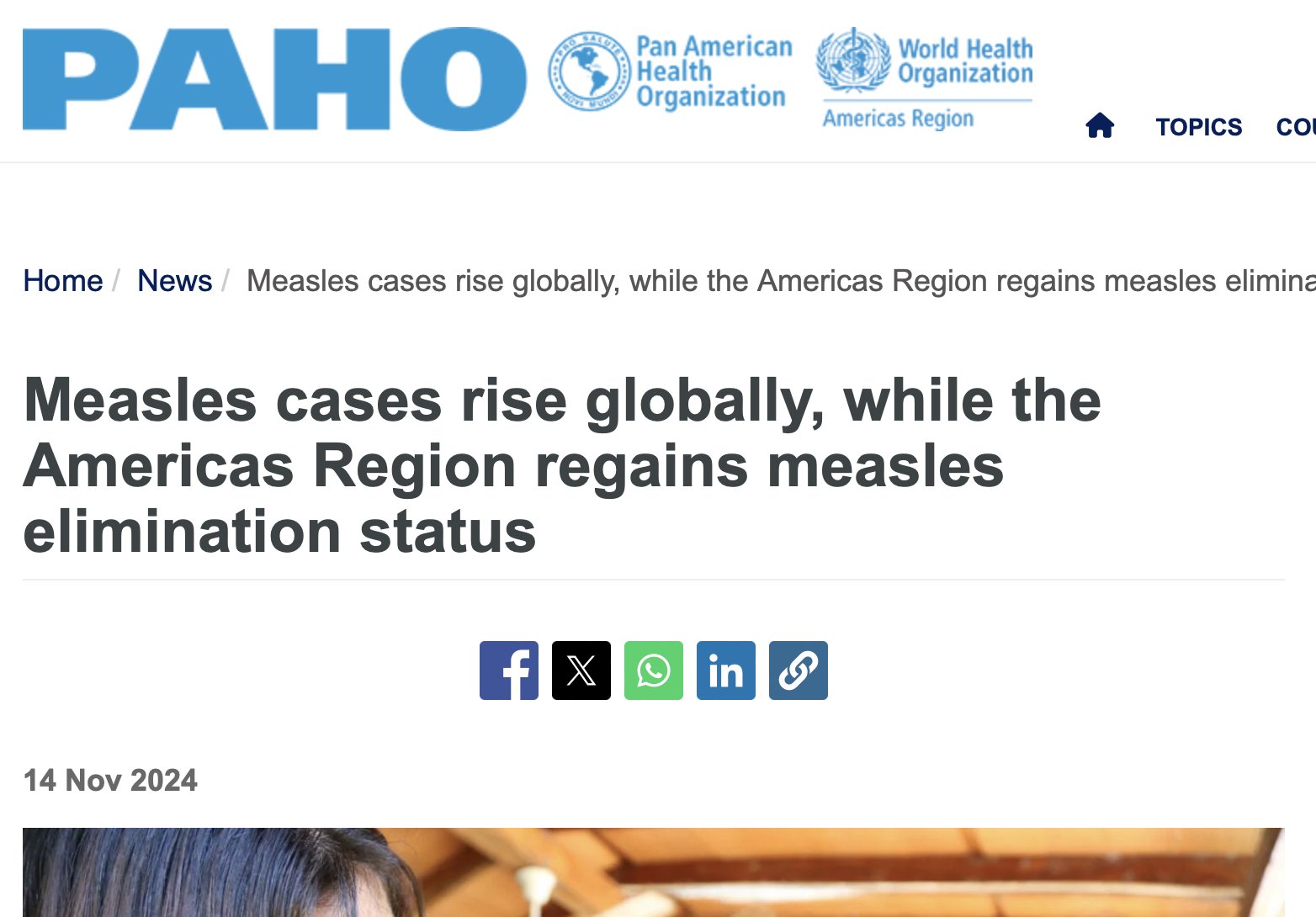 Measles Cases Rise Globally, Americas Regains Elimination Status