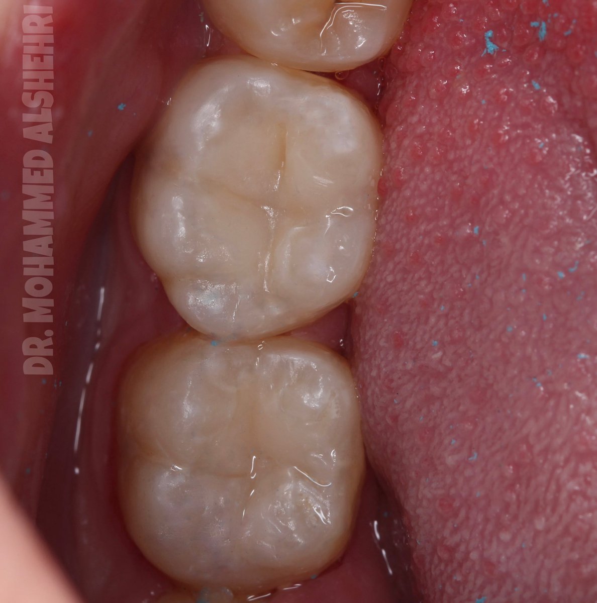 محمد الشهري tweet media