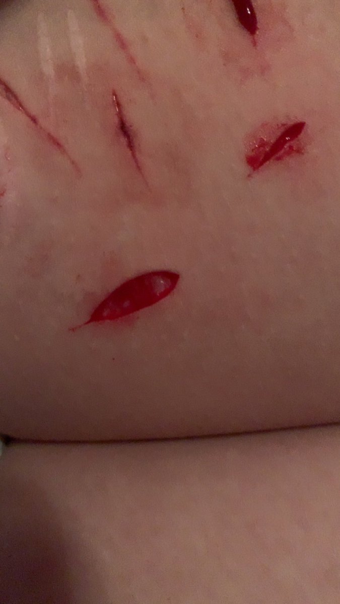 krytiaa's tweet photo. cut myself just like you said to☺️ are you happy now?🫶

not as deep as last nights but it’s okay, i’m tired. https://t.co/pExLAub7M9