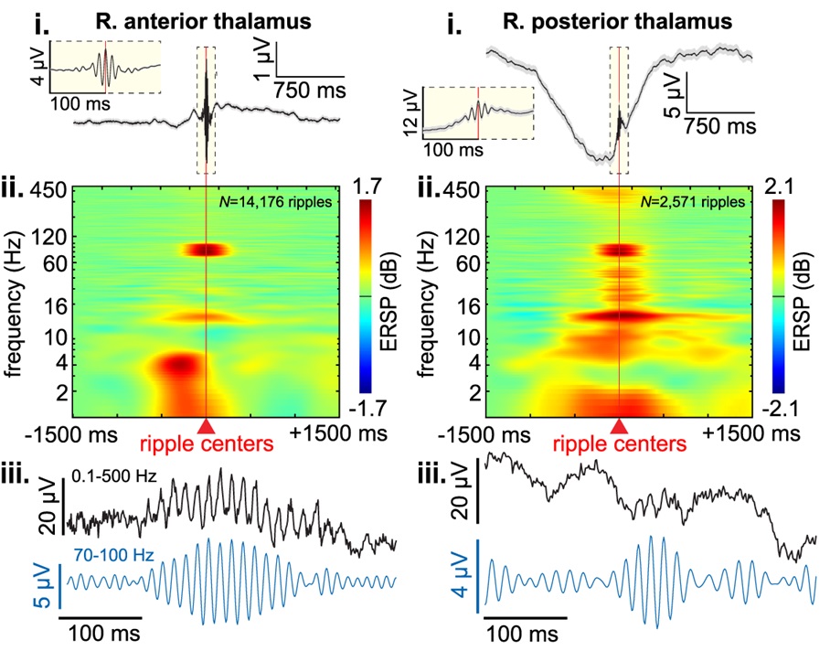 PLOSBiology's tweet image. The #thalamus syncs spindles &amp;amp; Up states in cortex for memory, but what about co-ripples in #hippocampus &amp;amp; neocortex? @cdickey_ &amp;amp;co show that during human sleep, thalamic spindles &amp;amp; Up states sync networks that regulate #memory consolidation #PLOSBiology plos.io/3UYXnkb