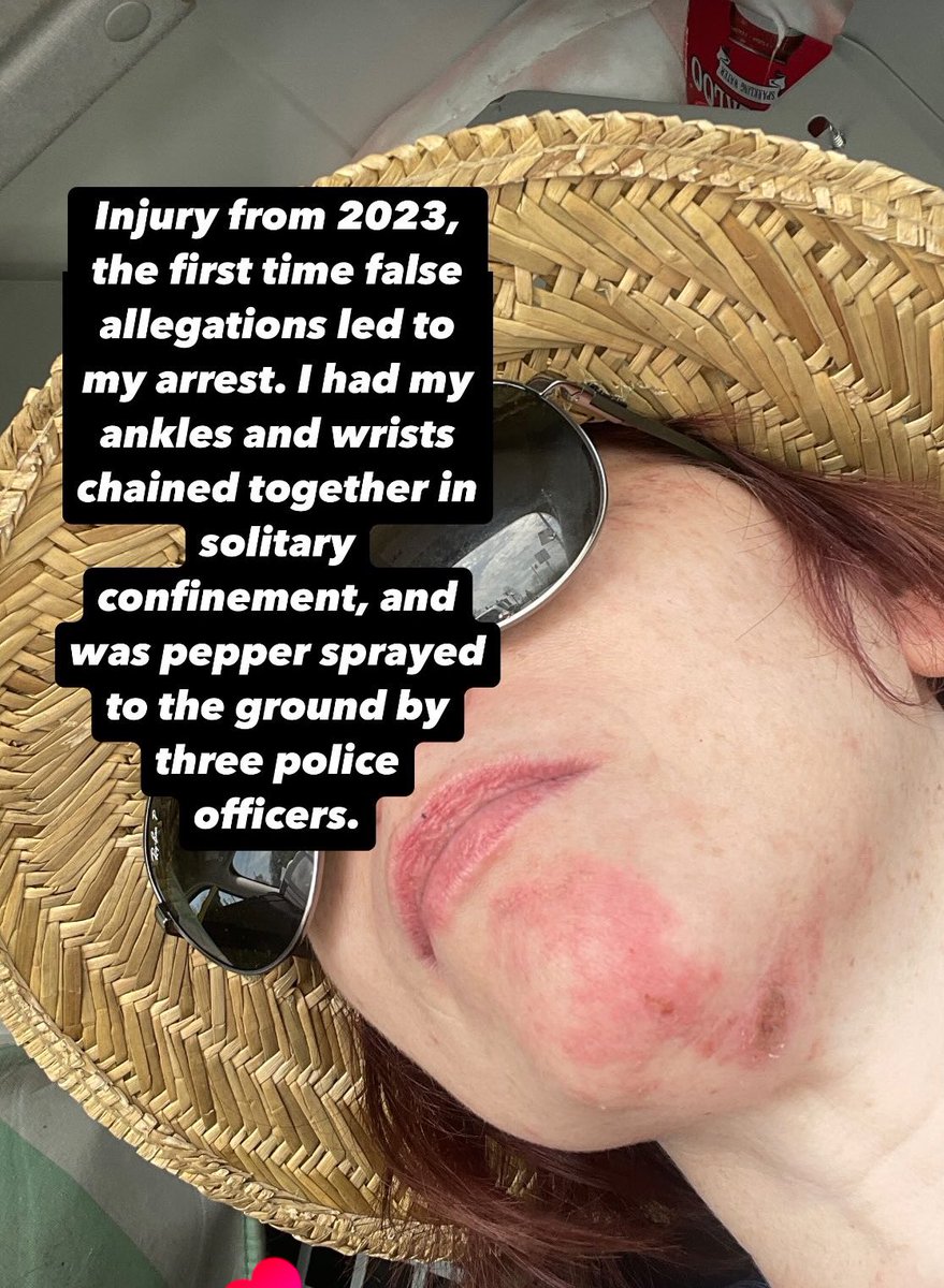 honeacat's tweet photo. @MNPDNashville @NC5 @DavidsonCoDA #falseallegations #divorce #dueprocess #excessiveforce https://t.co/DL04tB1Ysw