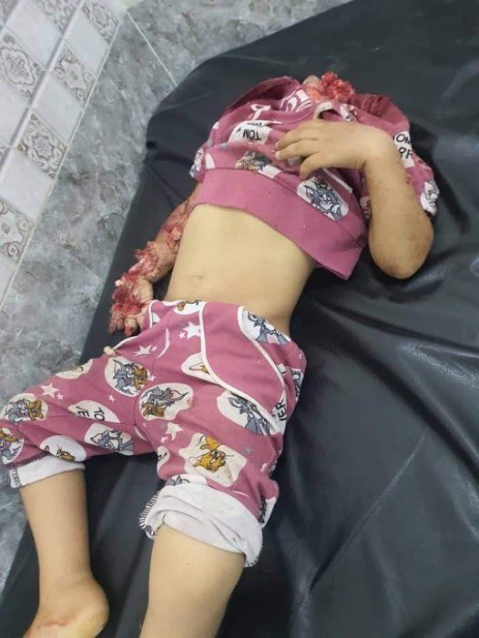 DreamzBrok95192's tweet image. @Fx1Jonny there's so many mate, I've got a file labeled Gaza file and I had a image in mind, 12 yr old Sirda Hassouma who was hanging from a wall he lower body blown off, but I came across so many that I just stopped scrolling. what these evil fuckers are doing is unbearable