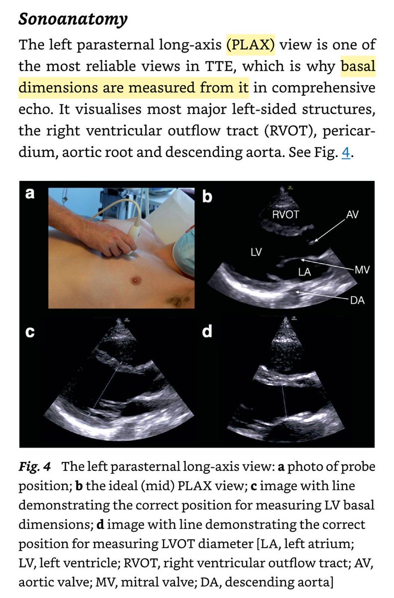 POCUSpeek's tweet image. 1. #firstecho basic views with annotations from 🔗doi.org/10.1007/978-3-… ← excellent #POCUS resource #heart