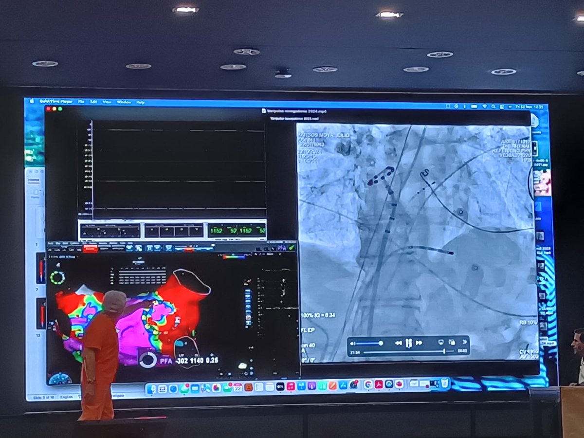 Hemos terminado el XXI Curso de Ablación y Sistemas de Navegación en #Electrofisiología #Cardiaca y el cierre ha sido ¡Estupendo! ¡Os esperamos en nuestra próxima edición! fibmed.org/congresos/nave…