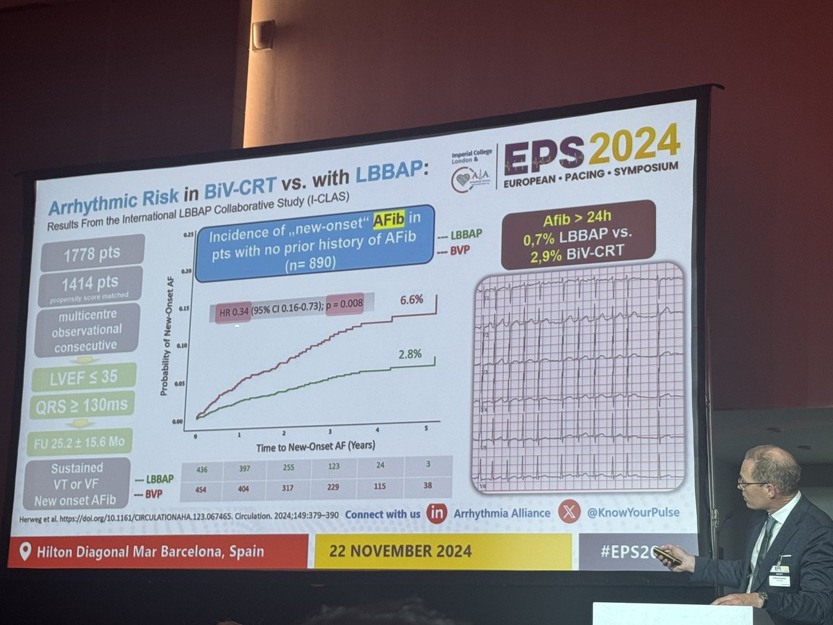 Jacqueline Joza (@dr_jozaep) on Twitter photo Underappreciated increase in ventricular arrhythmia with biv pacing possibly due to endo/epi dispersion.. needs to be further validated. Great presentation by <a href="/MDerndorfer/">Michael Derndorfer</a> <a href="/DASCAMaastricht/">DAS-CAM</a> <a href="/kvernooy/">Kevin Vernooy</a> <a href="/JLuermans/">Justin Luermans</a> Underappreciated increase in ventricular arrhythmia with biv pacing possibly due to endo/epi dispersion.. needs to be further validated. Great presentation by <a href="/MDerndorfer/">Michael Derndorfer</a> <a href="/DASCAMaastricht/">DAS-CAM</a> <a href="/kvernooy/">Kevin Vernooy</a> <a href="/JLuermans/">Justin Luermans</a>