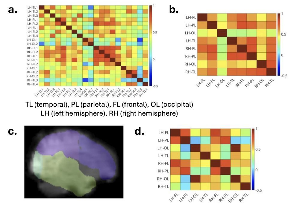 NIRx_NIRS's tweet photo. #fNIRS is increasingly being recommended as a bedside monitoring tool for #preterm #neonates. In this study, resting-state #FunctionalConnectivity was measured in neonates with intra-ventricular hemorrhage vs healthy controls using fNIRS and #fMRI.
🔗https://t.co/v0kbaSoxgW https://t.co/53XG6OO8G4