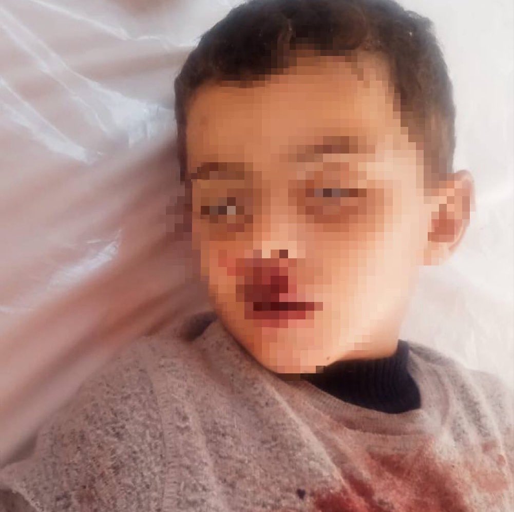 swilkinsonbc's tweet photo. Palestinian child Omar Salman is killed by the israelis while he was going to buy bread for his family in Al-Sheikh Ridwan neighbourhood of Gaza https://t.co/Jnhe8a57XE