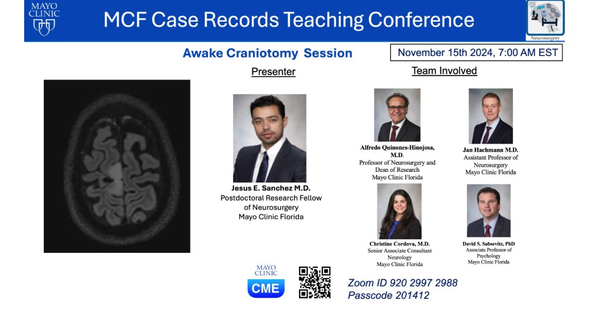 Adrian Safa M.D. (@adrian_safa) on Twitter photo Join us today at @7AM for our awake craniotomy session of the MCF Case Records Teaching Conference, with <a href="/JEmilianoSG/">J. Emiliano Sanchez-Garavito M.D.</a> presenting a very interesting case and his great work!
<a href="/DoctorQMd/">Dr. Alfredo QuiƱones-Hinojosa</a> <a href="/janhachmann/">Jan Hachmann MD MS MBA</a> <a href="/ManuelaAB99/">Manuela Aramburu Berckemeyer, MD</a> <a href="/MayoClinicNeuro/">Mayo Clinic Neuro</a> Join us today at @7AM for our awake craniotomy session of the MCF Case Records Teaching Conference, with <a href="/JEmilianoSG/">J. Emiliano Sanchez-Garavito M.D.</a> presenting a very interesting case and his great work!
<a href="/DoctorQMd/">Dr. Alfredo QuiƱones-Hinojosa</a> <a href="/janhachmann/">Jan Hachmann MD MS MBA</a> <a href="/ManuelaAB99/">Manuela Aramburu Berckemeyer, MD</a> <a href="/MayoClinicNeuro/">Mayo Clinic Neuro</a>