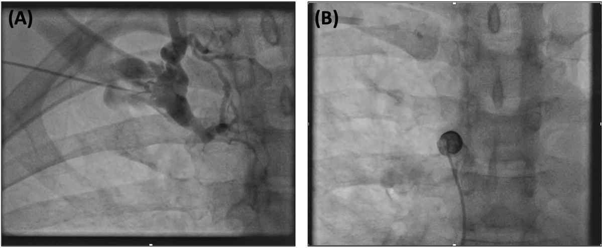 Heart Rhythm Case Reports tweet media