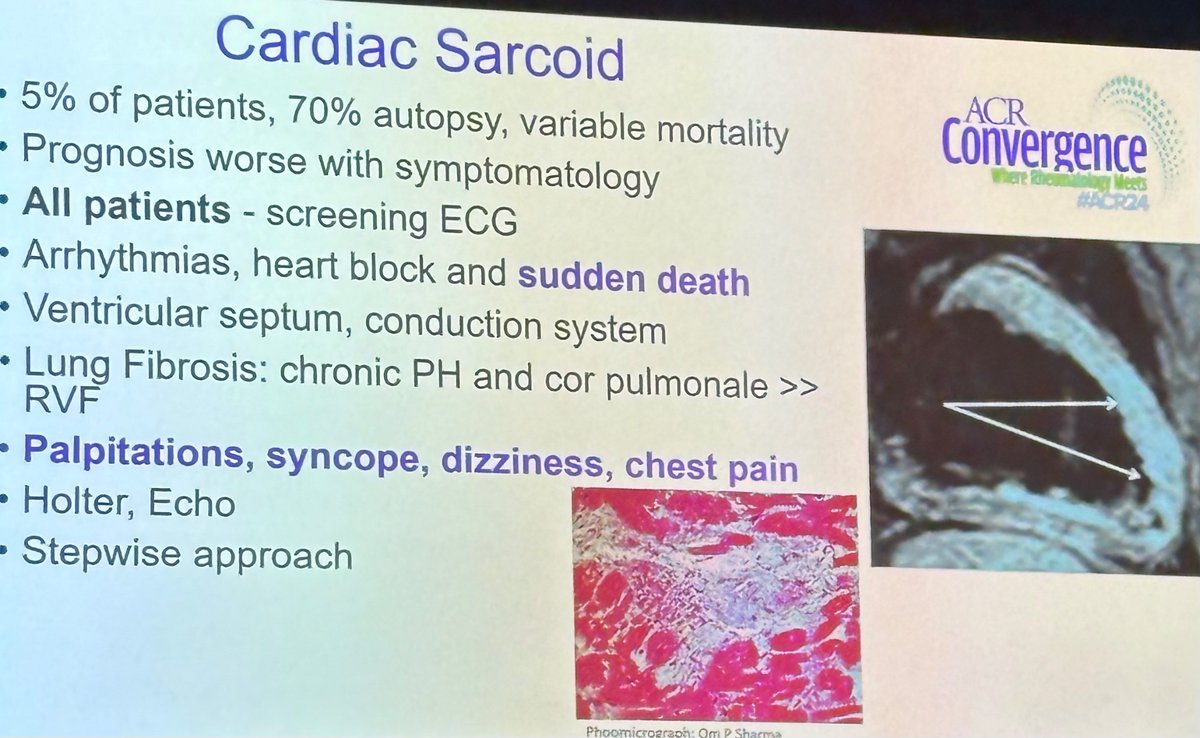 AdelaCastro222's tweet photo. “Sarcoidosis is biopsy supported not proven”
-Dx is clinical with broad ddx.
-Assess organ involvement in all pts.
-Whole body PET can help assess disease activity (not in CNS disease)
-MR brain with pituitary cuts helpful in CNS sarcoid.
#ACR24  @ACRheum @RheumNow https://t.co/prxXycUY3l