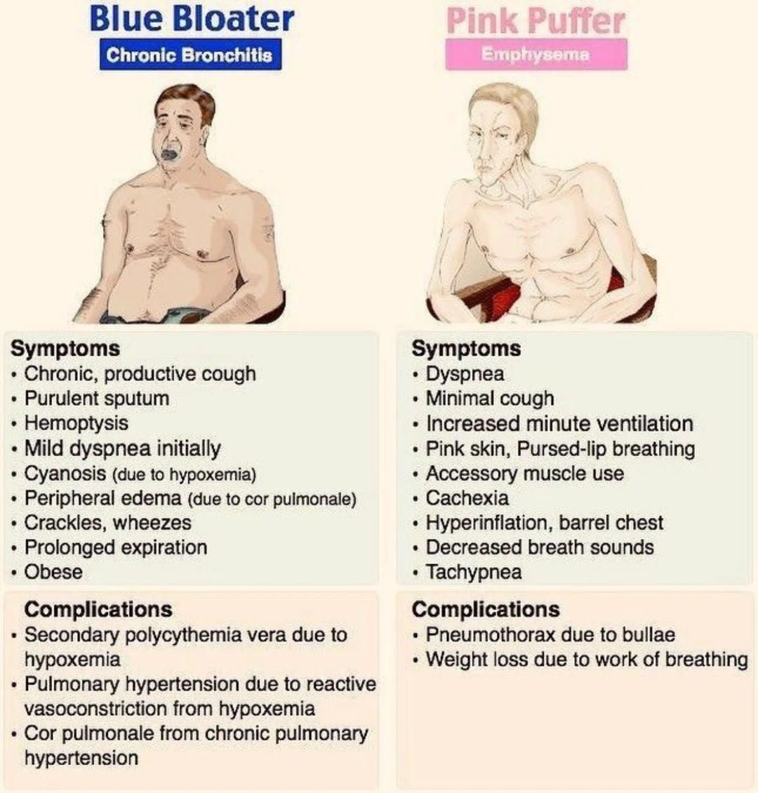 Doctors__squad's tweet image. 🍁Blue Bloater  Vs  Pink Puffer 📚