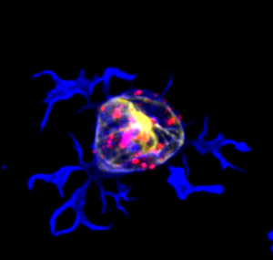 amnamusic22's tweet photo. Just some B cells acting like a little weirdos!

🔵Actin  🔴Lysosomes 💛Tubulin

#FluorescenceFriday #Bcells https://t.co/6E2EuyQF9M
