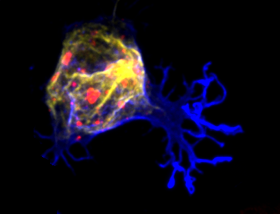 amnamusic22's tweet photo. Just some B cells acting like a little weirdos!

🔵Actin  🔴Lysosomes 💛Tubulin

#FluorescenceFriday #Bcells https://t.co/6E2EuyQF9M