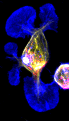 amnamusic22's tweet photo. Just some B cells acting like a little weirdos!

🔵Actin  🔴Lysosomes 💛Tubulin

#FluorescenceFriday #Bcells https://t.co/6E2EuyQF9M