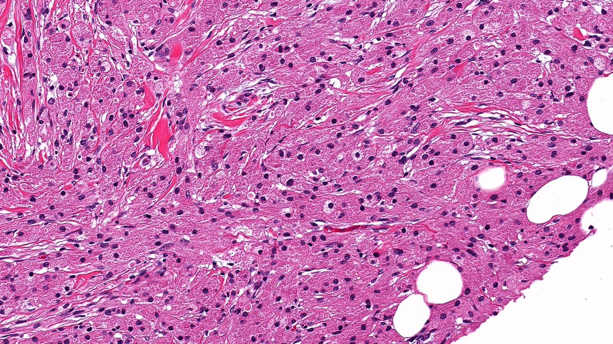 Raza Hoda MD tweet media