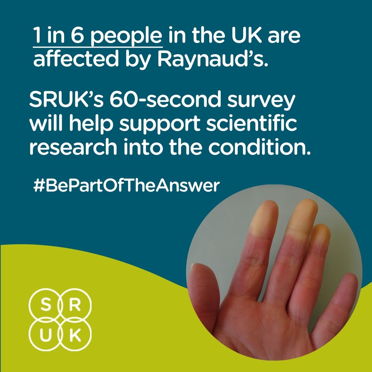 RareBeacon's tweet photo. Spare 60 seconds to take @WeAreSRUK's online Raynaud's symptom test. 📝

#BePartOfTheAnswer in helping unlock potential breakthroughs in diagnosis and treatment for debilitating autoimmune conditions like scleroderma.

Find out more: 👇

https://t.co/TPIkqusBi7 https://t.co/JYamsYmJki