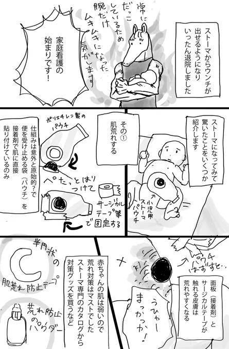 赤ちゃんのストーマ管理の話(1/3)
#漫画が読めるハッシュタグ
#ストーマ #小児ストーマ #人工肛門 #ヒルシュスプルング病 #レポ漫画 
#育児漫画 