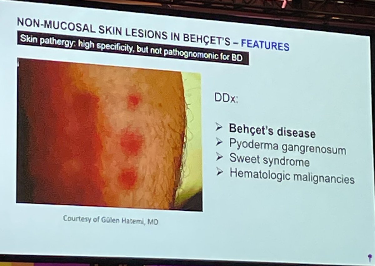 adil_fethi's tweet photo. Differentials for pathergy. Also cool images of vascular pathergy #ACR24 #ACRambassador https://t.co/0NuPfKB0ko