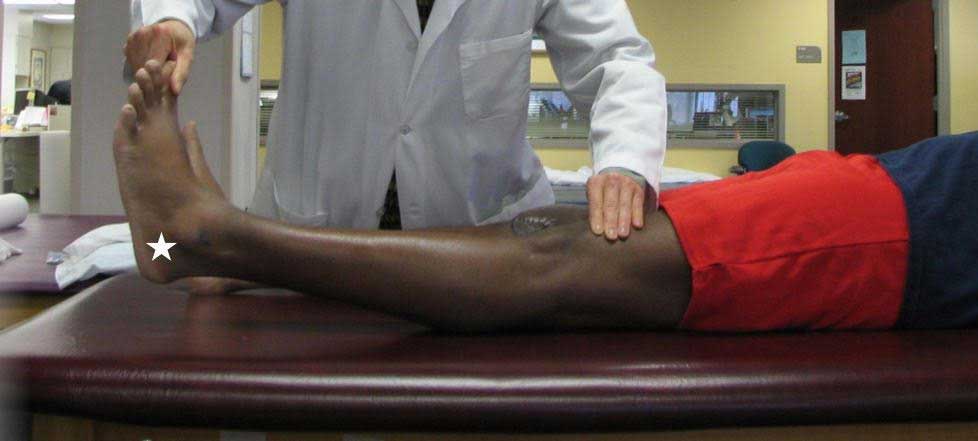 thekneedoc's tweet photo. Want to assess #GenuRecurvatum? It's as easy as measuring! Hold your thigh against a table, lift your great toe, and measure the heel height in cm. Each cm = 1 degree of hyperextension. Example: -5° = 5 cm heel height! Learn more: https://t.co/djxBs8xYYd #KneeHealth #KneeExam https://t.co/JNFnZUbDTQ
