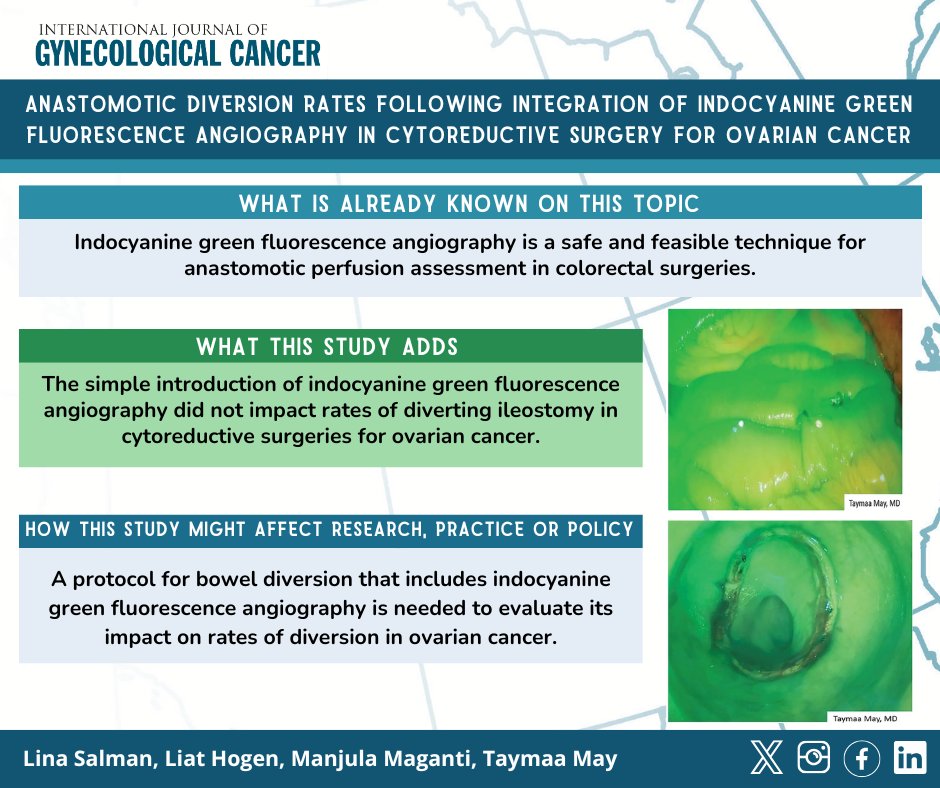 IJGC (@ijgconline) on Twitter photo Anastomotic diversion rates following integration of indocyanine green 🍏 fluorescence angiography in cytoreductive surgery for #ovariancancer
✅ bit.ly/3O92j2a
<a href="/pedroramirezMD/">Pedro T Ramirez</a> <a href="/HsuMd/">Arthur_HC_Hsu</a> <a href="/JayrajAarthi/">Aarthi S Jayraj</a> <a href="/AndreFernandes2/">Andreina Fernandes</a> <a href="/IGCSociety/">IGCS</a> <a href="/ESGO_society/">ESGO</a> <a href="/ENYGO_official/">European Network of Young Gynae Oncologists</a> <a href="/OncoAlert/">OncoAlert</a> Anastomotic diversion rates following integration of indocyanine green 🍏 fluorescence angiography in cytoreductive surgery for #ovariancancer
✅ bit.ly/3O92j2a
<a href="/pedroramirezMD/">Pedro T Ramirez</a> <a href="/HsuMd/">Arthur_HC_Hsu</a> <a href="/JayrajAarthi/">Aarthi S Jayraj</a> <a href="/AndreFernandes2/">Andreina Fernandes</a> <a href="/IGCSociety/">IGCS</a> <a href="/ESGO_society/">ESGO</a> <a href="/ENYGO_official/">European Network of Young Gynae Oncologists</a> <a href="/OncoAlert/">OncoAlert</a>