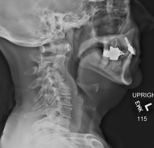 Ali A. Baaj MD tweet media