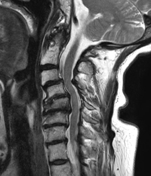 Ali A. Baaj MD tweet media