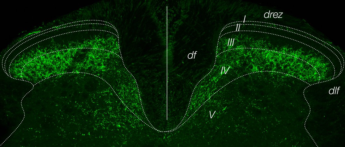 Farin B. Bourojeni tweet media
