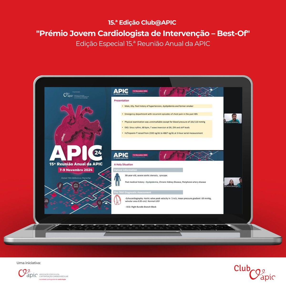 💻 𝗥𝗲𝗮𝗹𝗶𝘇𝗼𝘂-𝘀𝗲 𝗼𝗻𝘁𝗲𝗺 𝗮 𝟭𝟱.ª 𝗲𝗱𝗶𝗰̧𝗮̃𝗼 𝗱𝗼 𝗖𝗹𝘂𝗯@𝗔𝗣𝗜𝗖 𝘀𝗼𝗯 𝗼 𝘁𝗲𝗺𝗮 "𝗣𝗿𝗲́𝗺𝗶𝗼 𝗝𝗼𝘃𝗲𝗺 𝗖𝗮𝗿𝗱𝗶𝗼𝗹𝗼𝗴𝗶𝘀𝘁𝗮 𝗱𝗲 𝗜𝗻𝘁𝗲𝗿𝘃𝗲𝗻𝗰̧𝗮̃𝗼 – 𝗕𝗲𝘀𝘁-𝗢𝗳".

Esta foi uma edição dedicada aos trabalhos vencedores do Prémio Jovem