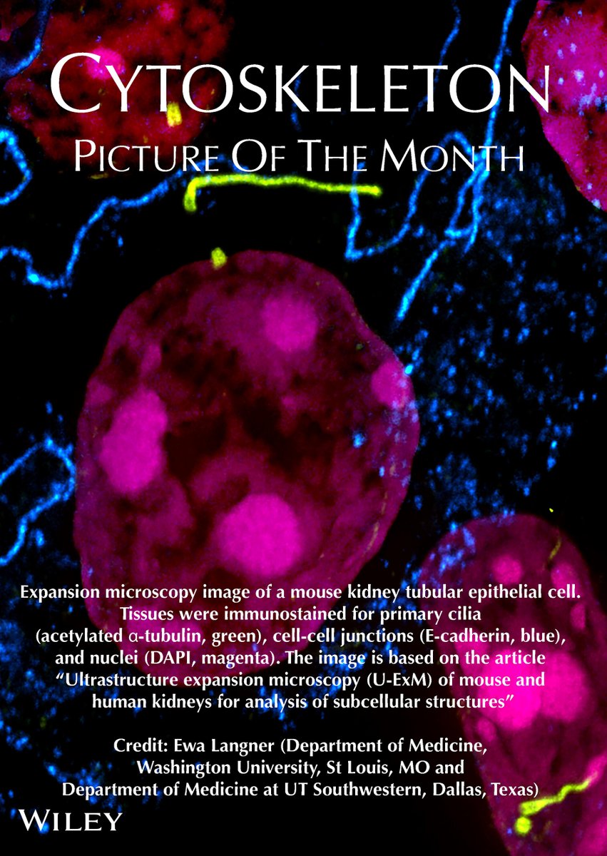 Cytoskeleton Journal (@cytoskeljournal) on Twitter photo For #FluorescenceFriday we have another wonderful #picture of the month in #CYTOSKELETON <a href="/CytoskelJournal/">Cytoskeleton Journal</a> Enjoy! <a href="/LangnerEP/">Ewa Langner</a> <a href="/MahjoubLab/">Moe Mahjoub 🇨🇦🍁</a> #microscopy #kidney For #FluorescenceFriday we have another wonderful #picture of the month in #CYTOSKELETON <a href="/CytoskelJournal/">Cytoskeleton Journal</a> Enjoy! <a href="/LangnerEP/">Ewa Langner</a> <a href="/MahjoubLab/">Moe Mahjoub 🇨🇦🍁</a> #microscopy #kidney
