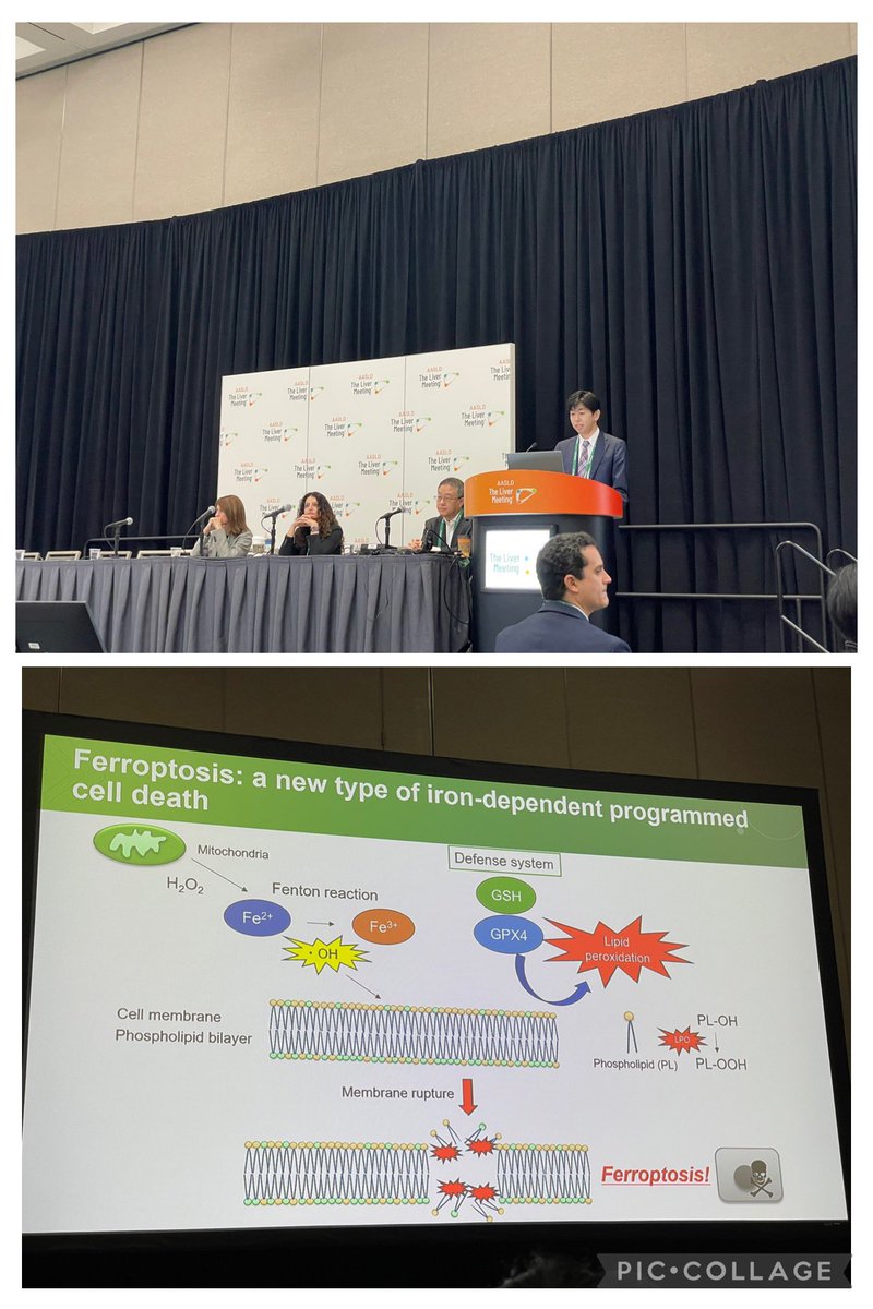 Eni Kostallari (@ekostallari_phd) on Twitter photo Starting #TLM24 with an outstanding Basic Science Symposium session 1 about cancer metabolism. Refreshing, new perspectives to study cell metabolism.
Thank you to the chairs <a href="/davidepovero/">Davide Povero, PhD, MBA</a> and #DanielaSia! Great moderation by <a href="/SumeraIlyasMD/">Sumera Ilyas</a> and <a href="/HoshidaYujin/">Yujin Hoshida</a>! Starting #TLM24 with an outstanding Basic Science Symposium session 1 about cancer metabolism. Refreshing, new perspectives to study cell metabolism.
Thank you to the chairs <a href="/davidepovero/">Davide Povero, PhD, MBA</a> and #DanielaSia! Great moderation by <a href="/SumeraIlyasMD/">Sumera Ilyas</a> and <a href="/HoshidaYujin/">Yujin Hoshida</a>!