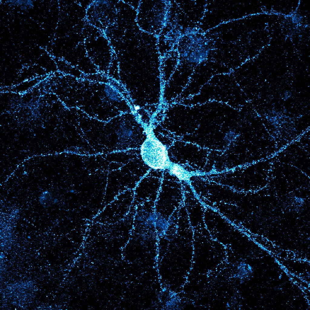 Can I ask you to share a PhD advert at Bristol Uni please? Rhomboid proteases play a role in neurons that is essential for life- but it is not characterised. Got a student interested in cell biology, electrophysiology and neurobiology? Send them our way! tinyurl.com/56f24f7c