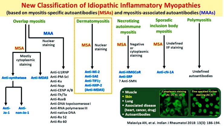 Classification of Idiopathic Inflammatory Myositis #MedX