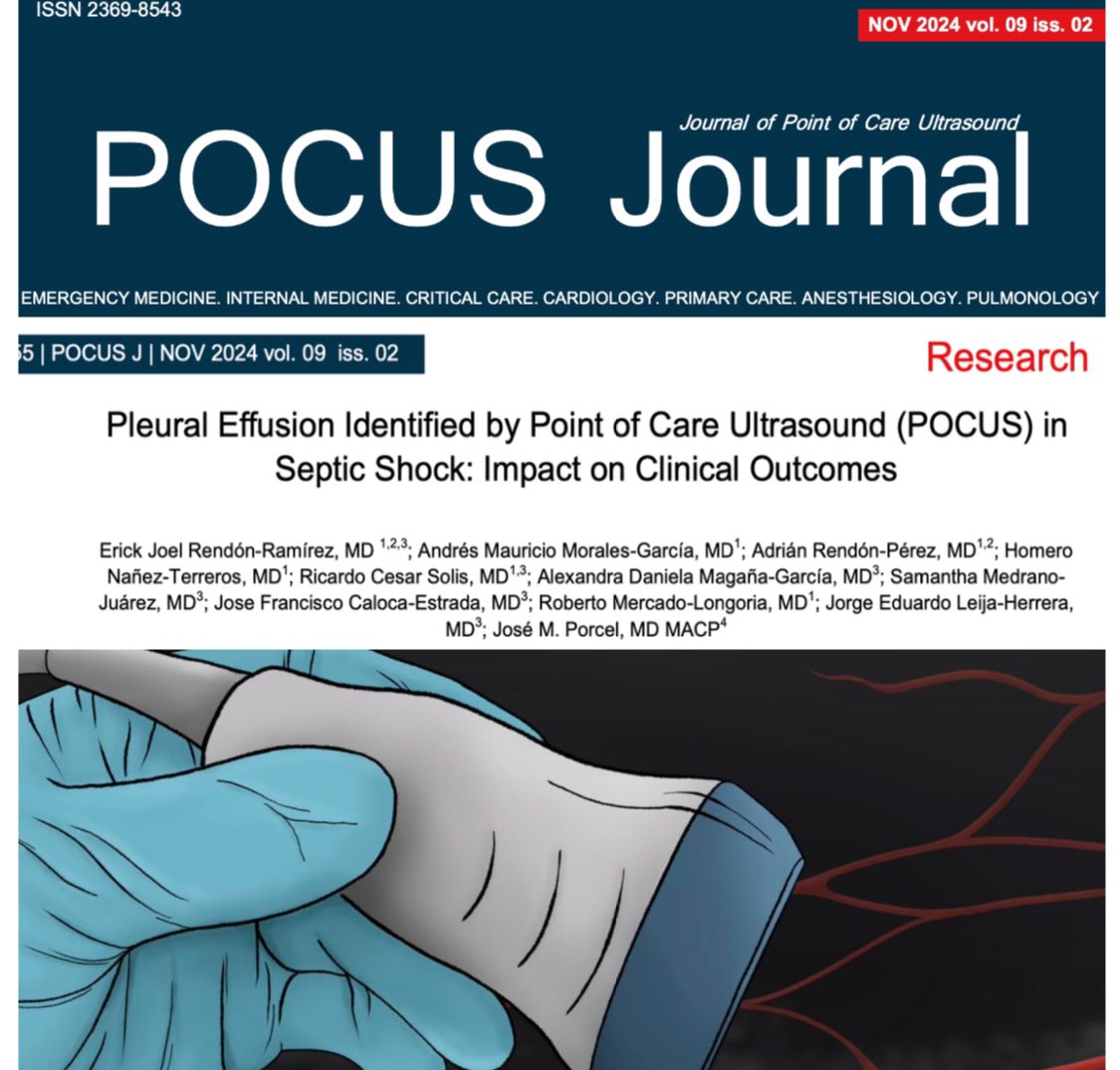 ErickRendonMD's tweet photo. The detection of pleural effusion using ultrasound is associated with higher rates of hospitalization, mechanical ventilation, and mortality, particularly in cases with larger effusion volumes. Many thanks to all the researchers involved. https://t.co/q832yYNaYw