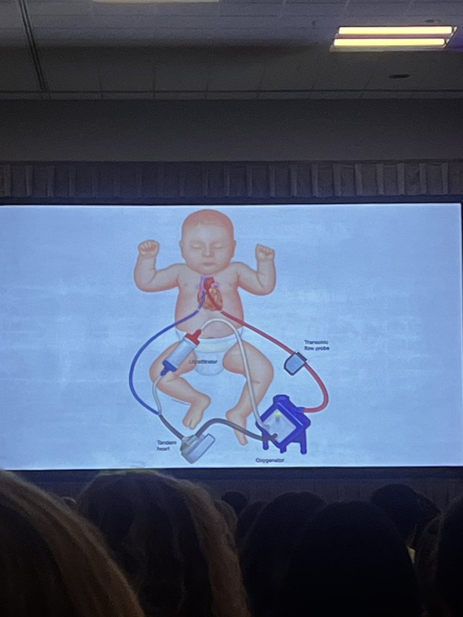 Is it oxy VAD or is it ECMO? Implanting VAD cannulas and adding an oxygenator. #pcics24 Great session on long term support of heart failure patients in the CICU