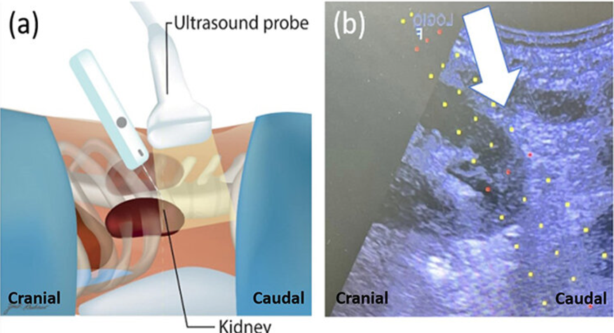 Avel con V chica 🥸 tweet media