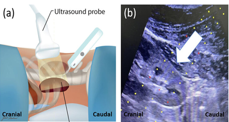 Avel con V chica 🥸 tweet media
