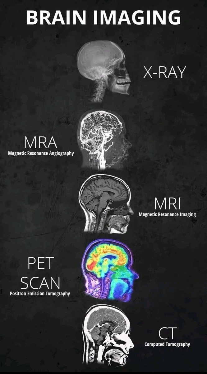 MoarSahitoPTI's tweet photo. Brain imaging. 🧠 https://t.co/QzjRYQlA7i