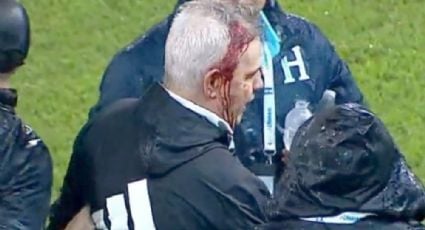 soyluisgabriel1's tweet photo. 💥 Javier Aguirre recibe un #botellazo y sale ensangrentado tras la derrota de #México en #Honduras.
El director técnico de @miseleccionmx resultó herido una vez que el árbitro pitó el final del partido, esto luego de salir de su zona técnica para despedirse del rival y en su trayecto fuera atacado por lo que se presume era una botella. 🇲🇽🇭🇳