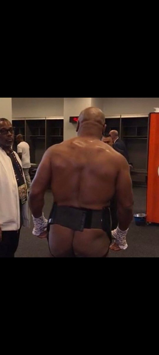 Ni la calle de mí casa tiene tantos pozos y eso que es de tierra